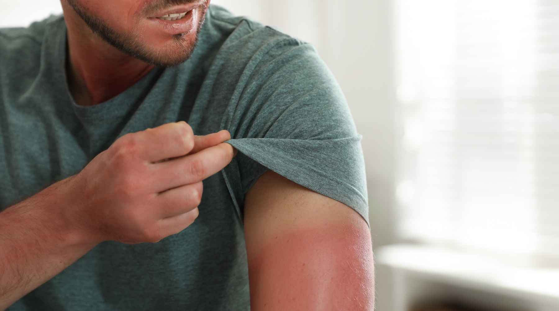 Infrared Sauna and Sunburn: Is Sauna Good For Sunburn?